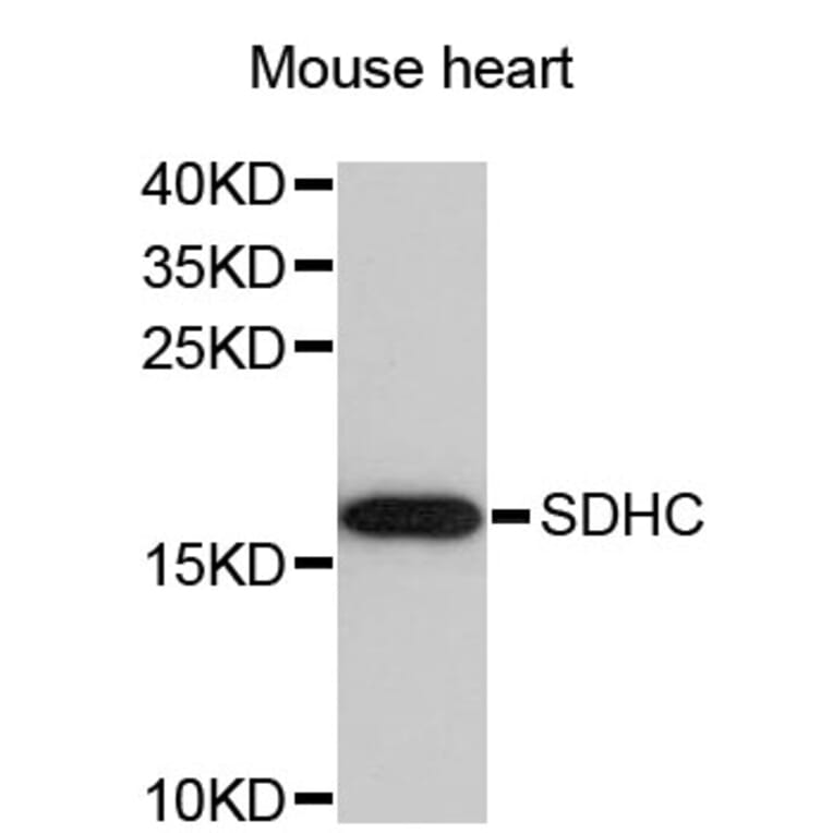 Western Blot - Anti-SDHC Antibody (A4106) - Antibodies.com