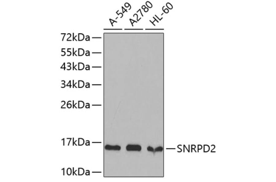 Western Blot - Anti-SNRPD2 Antibody (A4120) - Antibodies.com