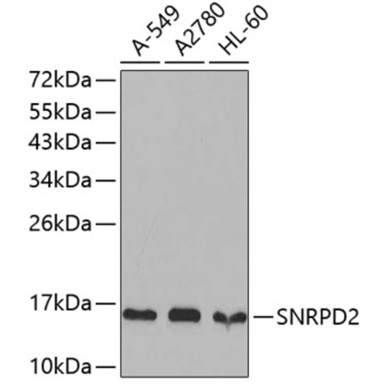 Western Blot - Anti-SNRPD2 Antibody (A4120) - Antibodies.com