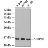 Western Blot - Anti-SNRPD2 Antibody (A4120) - Antibodies.com