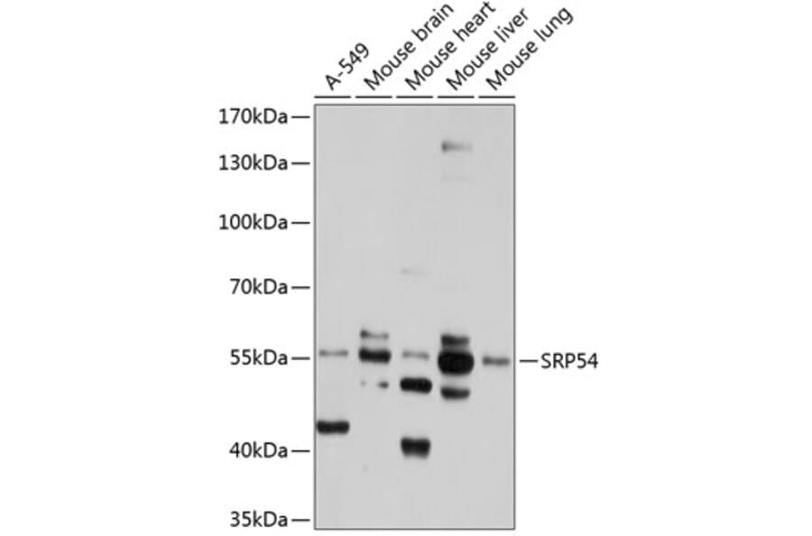 Western Blot - Anti-SRP54 Antibody (A11722) - Antibodies.com