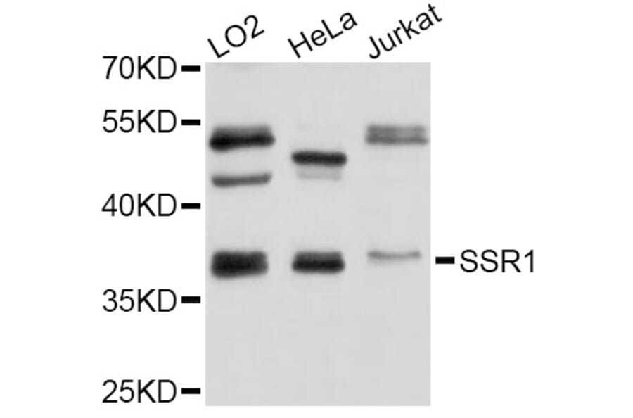 Western Blot - Anti-SSR1 Antibody (A4129) - Antibodies.com