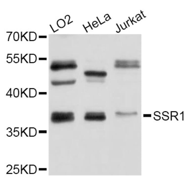 Western Blot - Anti-SSR1 Antibody (A4129) - Antibodies.com
