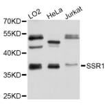 Western Blot - Anti-SSR1 Antibody (A4129) - Antibodies.com