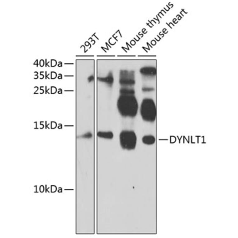 Western Blot - Anti-TCTEX-1 Antibody (A11725) - Antibodies.com