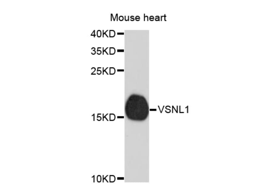 Western Blot - Anti-VSNL1 Antibody (A4185) - Antibodies.com