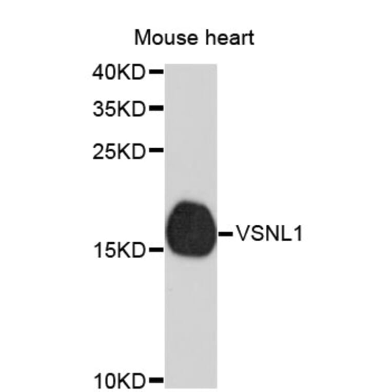 Western Blot - Anti-VSNL1 Antibody (A4185) - Antibodies.com