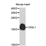 Western Blot - Anti-VSNL1 Antibody (A4185) - Antibodies.com