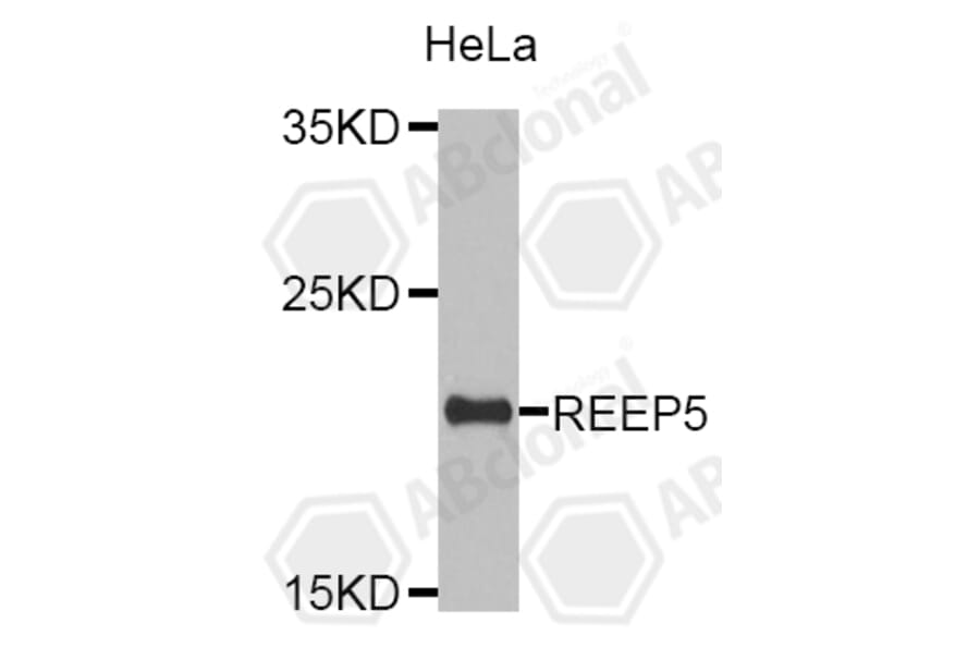 Western Blot - Anti-REEP5 Antibody (A4191) - Antibodies.com