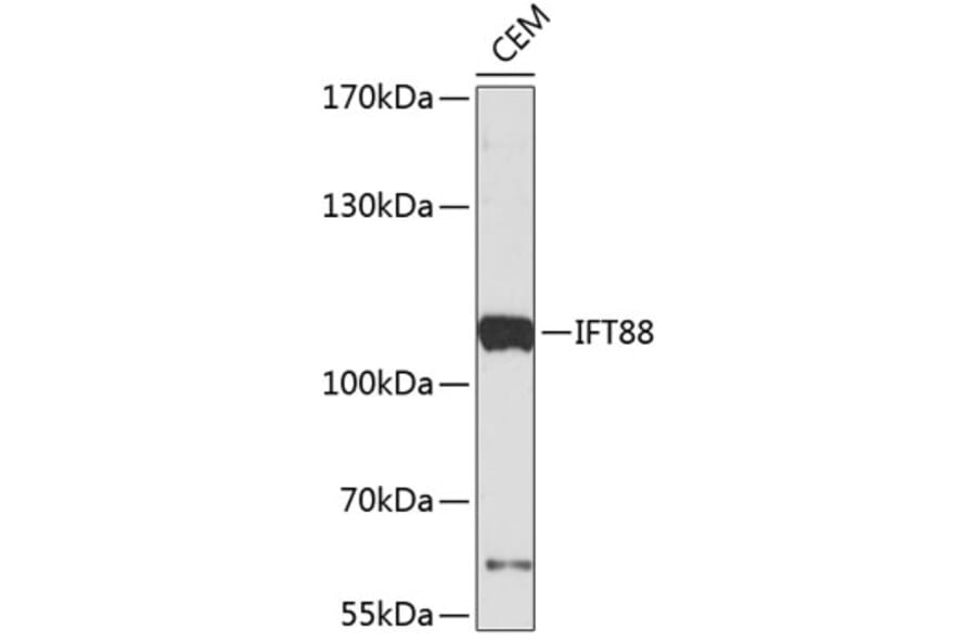 Western Blot - Anti-IFT88 Antibody (A4204) - Antibodies.com