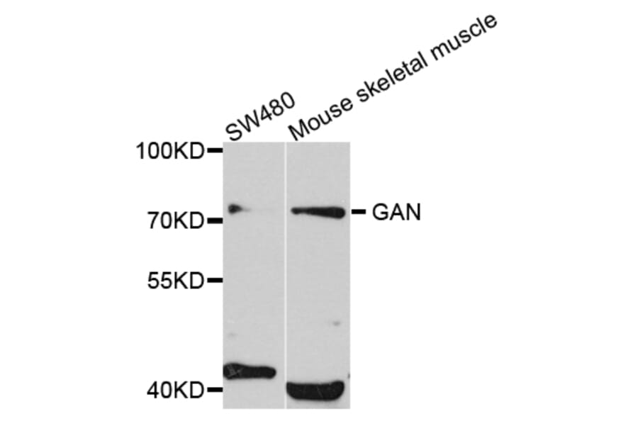 Western Blot - Anti-GAN Antibody (A4205) - Antibodies.com