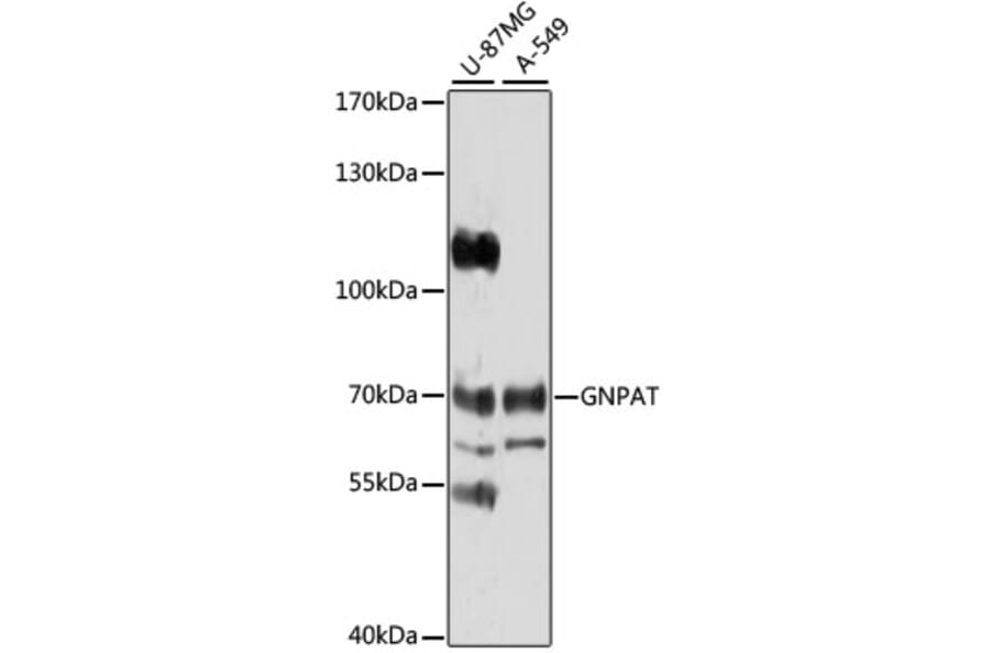 Western Blot - Anti-GNPAT Antibody (A4220) - Antibodies.com