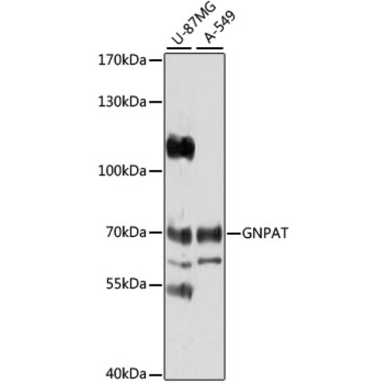 Western Blot - Anti-GNPAT Antibody (A4220) - Antibodies.com