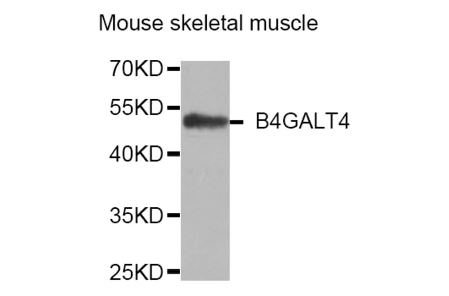 Western Blot - Anti-B4GALT4 Antibody (A4244) - Antibodies.com