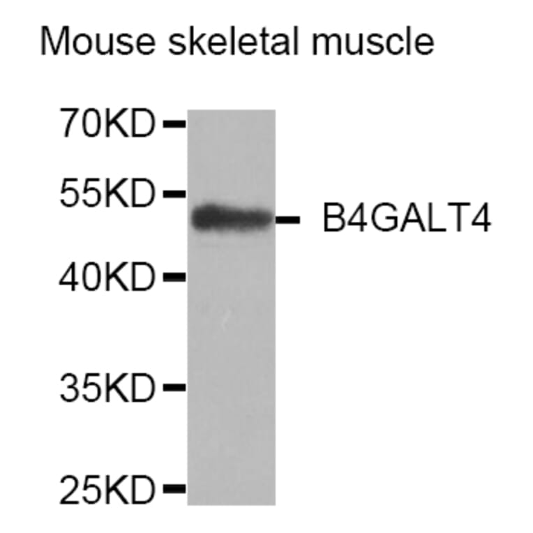 Western Blot - Anti-B4GALT4 Antibody (A4244) - Antibodies.com