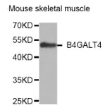 Western Blot - Anti-B4GALT4 Antibody (A4244) - Antibodies.com