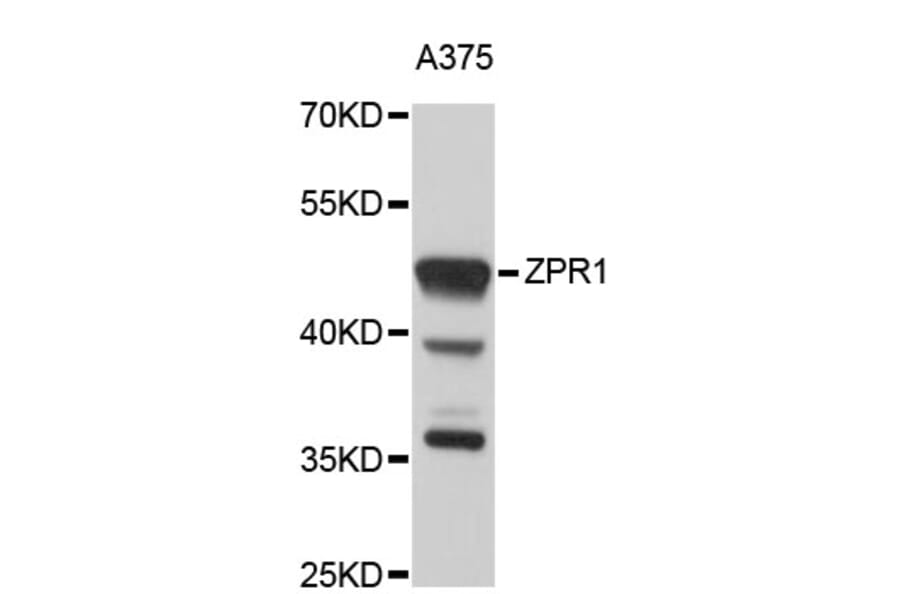 Western Blot - Anti-ZPR1 Antibody (A4253) - Antibodies.com