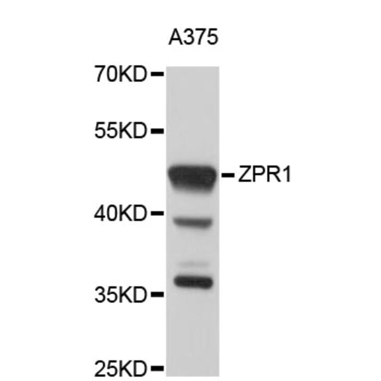 Western Blot - Anti-ZPR1 Antibody (A4253) - Antibodies.com