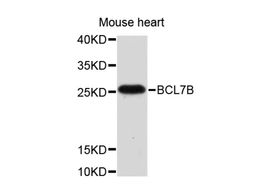 Western Blot - Anti-BCL7B Antibody (A4285) - Antibodies.com