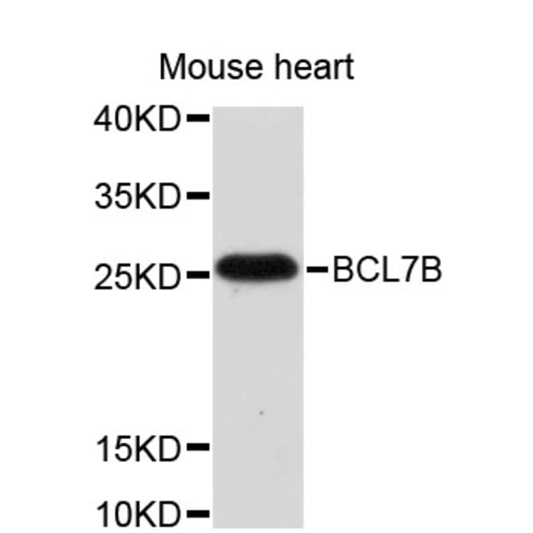 Western Blot - Anti-BCL7B Antibody (A4285) - Antibodies.com