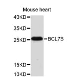 Western Blot - Anti-BCL7B Antibody (A4285) - Antibodies.com