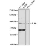 Western Blot - Anti-Phospholipase A2 activator protein (phospho LAP) Antibody (A11738) - Antibodies.com