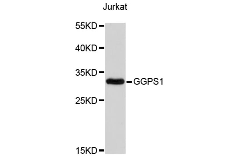 Western Blot - Anti-GGPS1 Antibody (A4300) - Antibodies.com