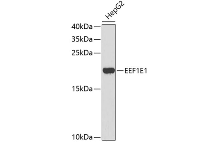 Western Blot - Anti-EEF1E1 Antibody (A4314) - Antibodies.com