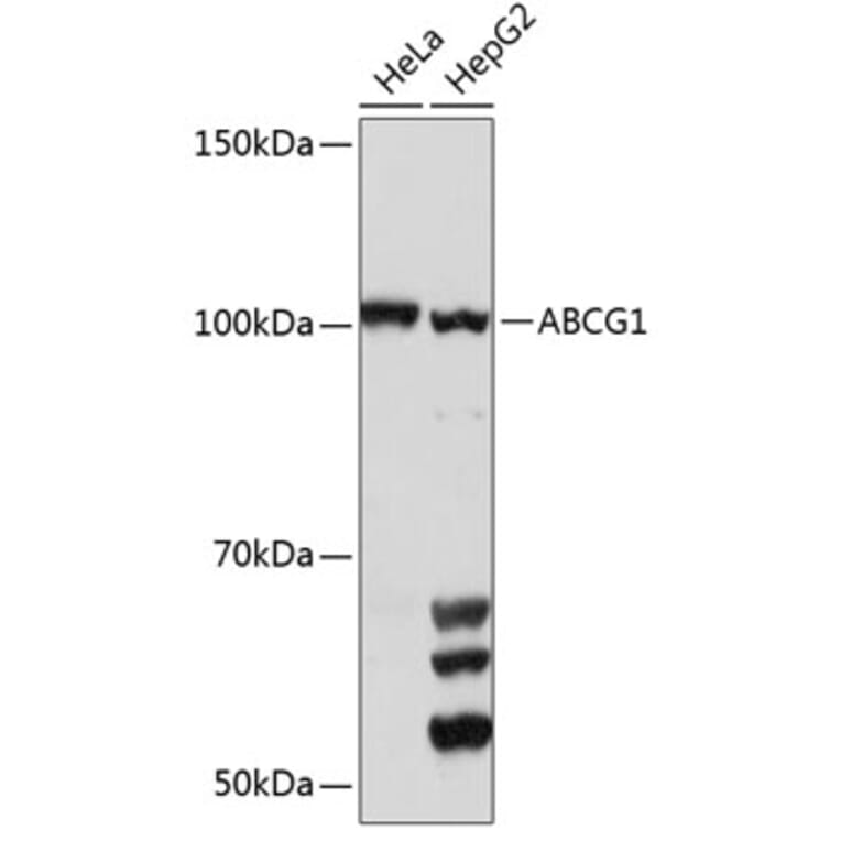 Western Blot - Anti-ABCG1 Antibody (A11743) - Antibodies.com