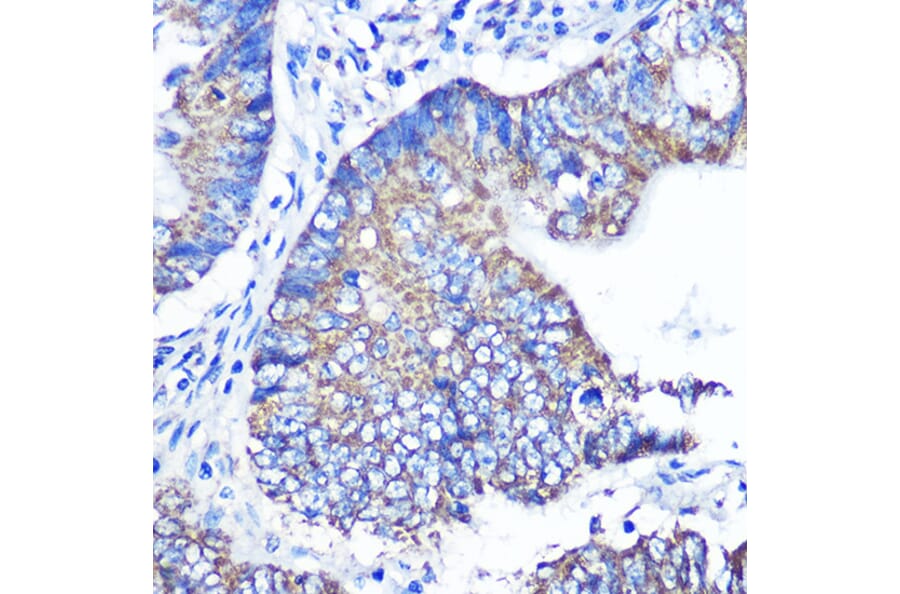 Immunohistochemistry - Anti-ABCG1 Antibody (A11743) - Antibodies.com