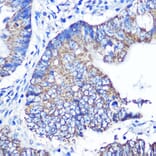 Immunohistochemistry - Anti-ABCG1 Antibody (A11743) - Antibodies.com