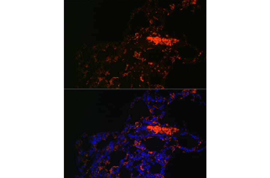 Immunofluorescence - Anti-ABCG1 Antibody (A11743) - Antibodies.com
