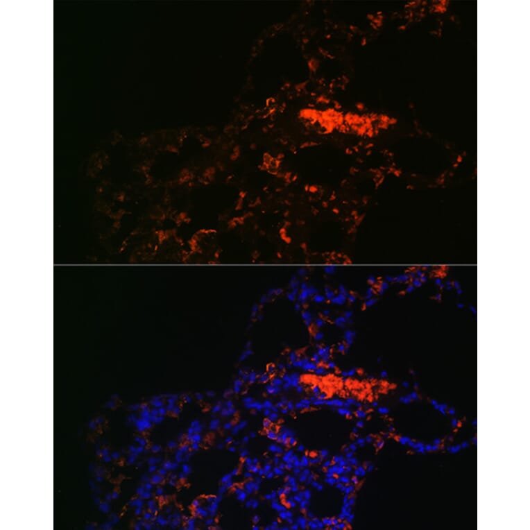 Immunofluorescence - Anti-ABCG1 Antibody (A11743) - Antibodies.com