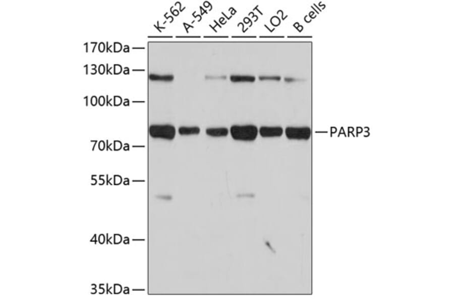 Western Blot - Anti-PARP3 Antibody (A4360) - Antibodies.com