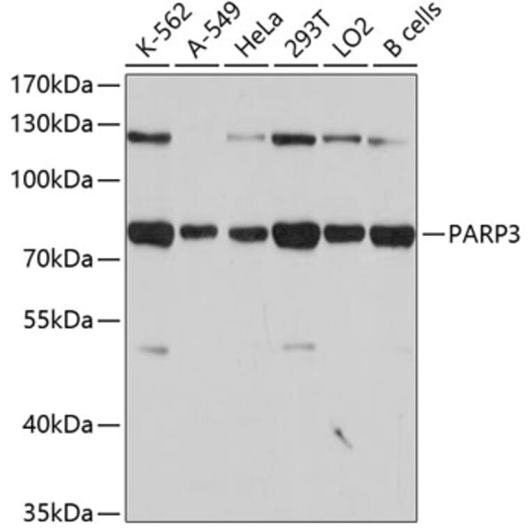 Western Blot - Anti-PARP3 Antibody (A4360) - Antibodies.com