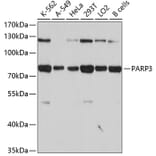 Western Blot - Anti-PARP3 Antibody (A4360) - Antibodies.com