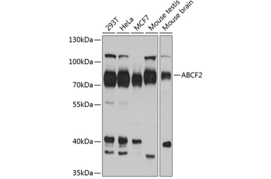 Western Blot - Anti-ABCF2 Antibody (A11745) - Antibodies.com