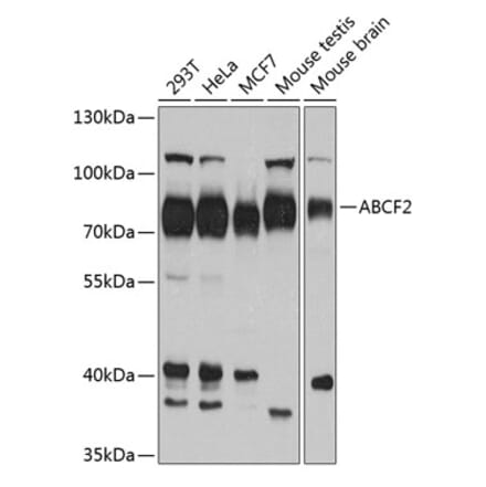 Western Blot - Anti-ABCF2 Antibody (A11745) - Antibodies.com