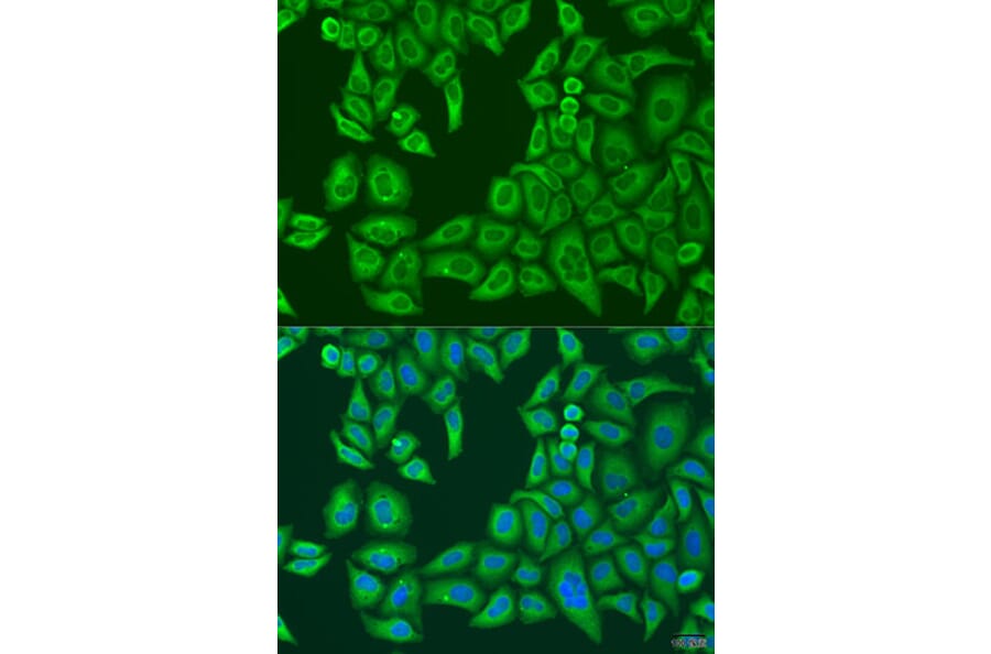 Immunofluorescence - Anti-ABCF2 Antibody (A11745) - Antibodies.com