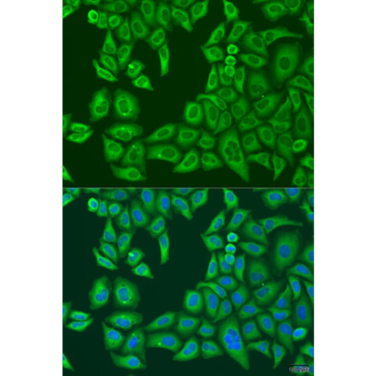 Immunofluorescence - Anti-ABCF2 Antibody (A11745) - Antibodies.com