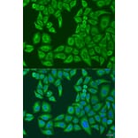 Immunofluorescence - Anti-ABCF2 Antibody (A11745) - Antibodies.com