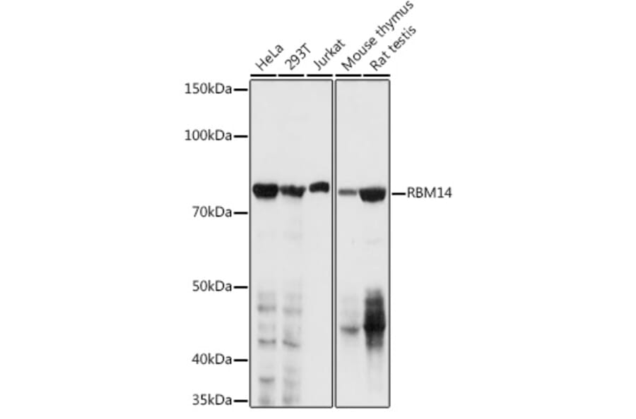 Western Blot - Anti-RBM14 Antibody (A11747) - Antibodies.com