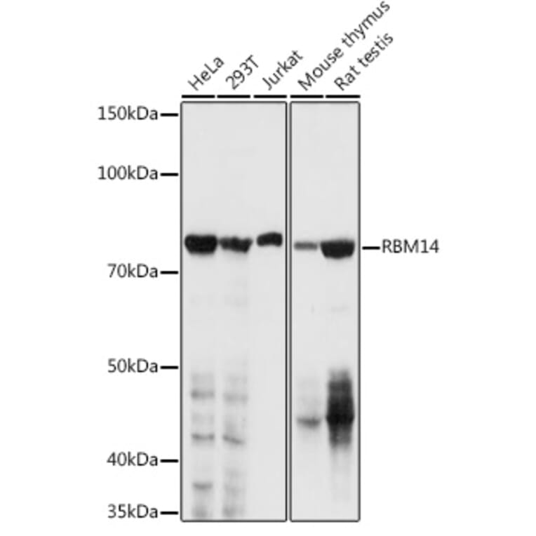 Western Blot - Anti-RBM14 Antibody (A11747) - Antibodies.com