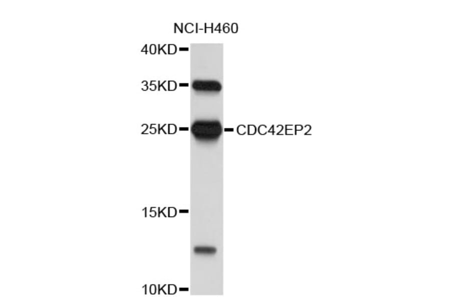 Western Blot - Anti-CDC42EP2 Antibody (A4420) - Antibodies.com