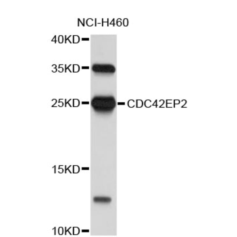 Western Blot - Anti-CDC42EP2 Antibody (A4420) - Antibodies.com