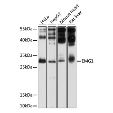 Western Blot - Anti-EMG1 Antibody (A11749) - Antibodies.com