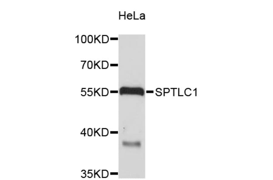 Western Blot - Anti-SPTLC1 Antibody (A4434) - Antibodies.com