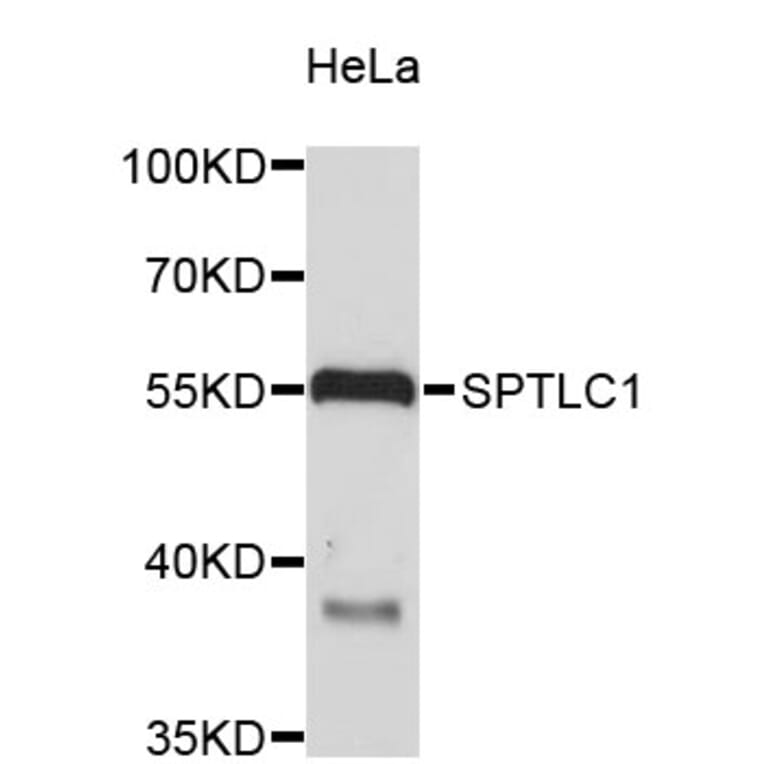 Western Blot - Anti-SPTLC1 Antibody (A4434) - Antibodies.com