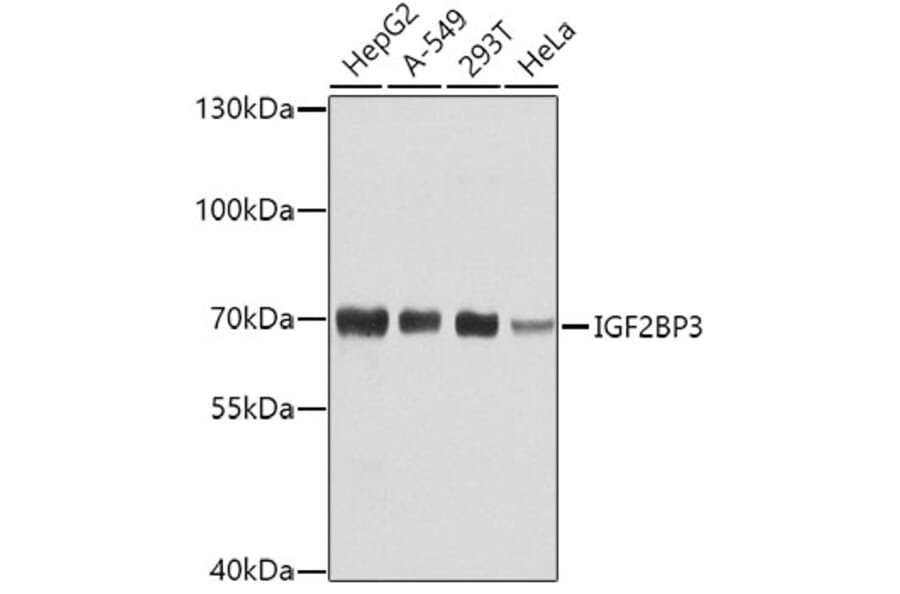 Western Blot - Anti-IMP3 Antibody (A11751) - Antibodies.com