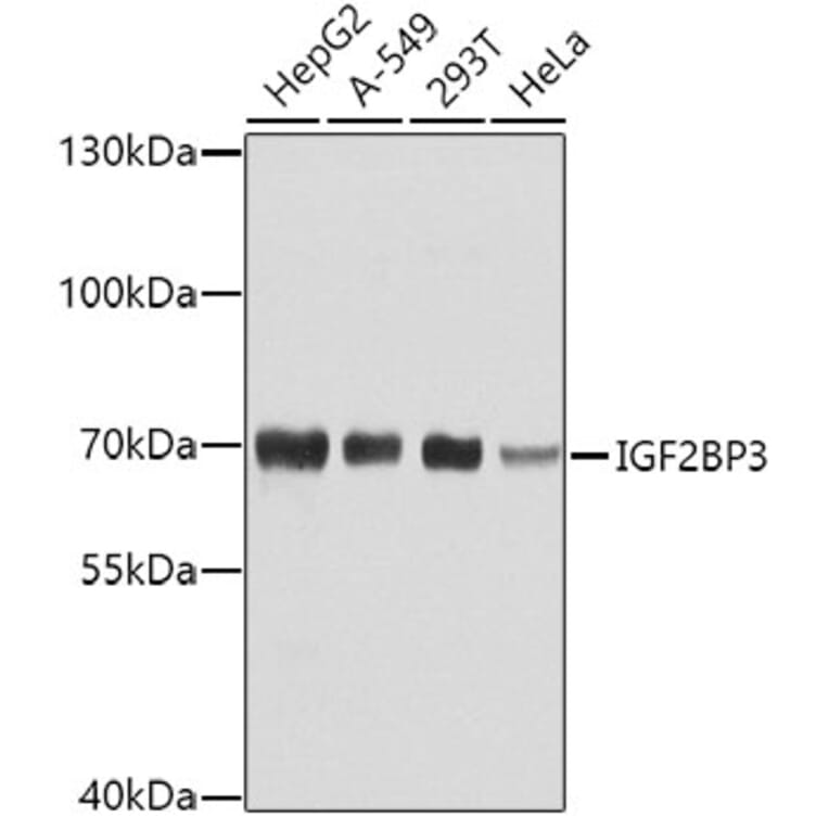 Western Blot - Anti-IMP3 Antibody (A11751) - Antibodies.com